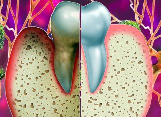 The Impact of Tooth Loss and Periodontitis on Hippocampal Atrophy: A Longitudinal Study in Late Middle-Aged and Older Adults