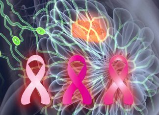 Il ruolo degli inibitori specifici di RAGE nella compromissione della progressione e delle metastasi del carcinoma mammario triplo negativo (TNBC)