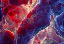 ACE2-Mediated Endothelial Inflammation in COVID-19