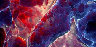 ACE2-Mediated Endothelial Inflammation in COVID-19