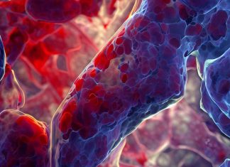 ACE2-Mediated Endothelial Inflammation in COVID-19