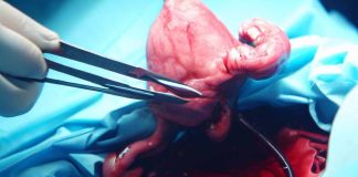 Advancements in Uterine Transplantation: A Quarter Century of Preclinical Research and Clinical Milestones