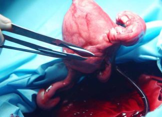 Advancements in Uterine Transplantation: A Quarter Century of Preclinical Research and Clinical Milestones
