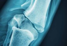 Oral Corticosteroid Prescribing Patterns and Fracture Preventive Care