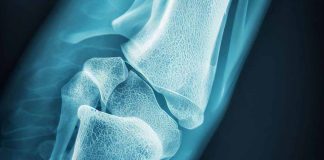 Oral Corticosteroid Prescribing Patterns and Fracture Preventive Care