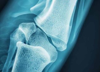 Oral Corticosteroid Prescribing Patterns and Fracture Preventive Care