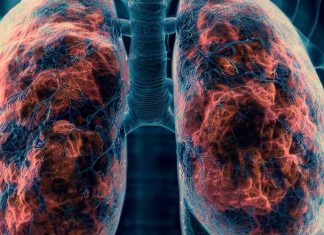 Rituximab and Cancer Chemotherapeutic Drugs: Implications for Post-COVID-19 Pulmonary Fibrosis Risk – A Nationwide Cohort Study