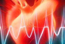 The Link Between SARS-CoV-2 Infection and New-Onset Atrial Fibrillation