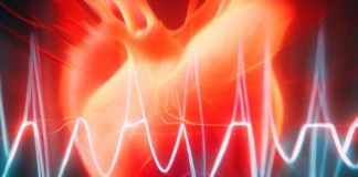 The Link Between SARS-CoV-2 Infection and New-Onset Atrial Fibrillation