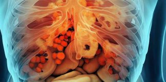 Targeting Fatty Acid Biosynthesis: Unraveling the Antifungal Potential of NPD6433