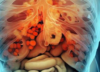 Targeting Fatty Acid Biosynthesis: Unraveling the Antifungal Potential of NPD6433