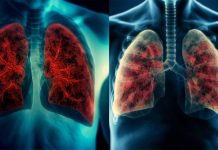Exploring the Interplay of Vitamin D, Tuberculosis, and COVID-19 Severity in Mongolia
