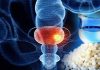 Exploring the Intersection of Bladder Cancer, COVID-19, and Pachymic Acid