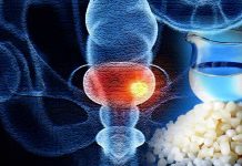 Exploring the Intersection of Bladder Cancer, COVID-19, and Pachymic Acid