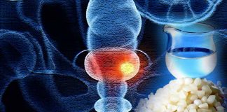 Exploring the Intersection of Bladder Cancer, COVID-19, and Pachymic Acid