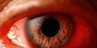 Exploring the Link Between Calcium Channel Blockers and Glaucoma: Findings from a UK Biobank Study