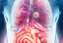 Multiorgan Abnormalities in Post-Hospitalized COVID-19 Patients