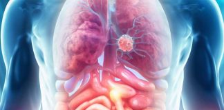 Multiorgan Abnormalities in Post-Hospitalized COVID-19 Patients