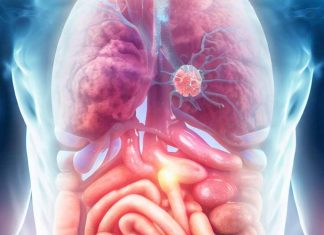 Multiorgan Abnormalities in Post-Hospitalized COVID-19 Patients