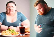 Obesity: A Multifactorial Challenge at the Intersection of Biology, Psychology, and Food Environments