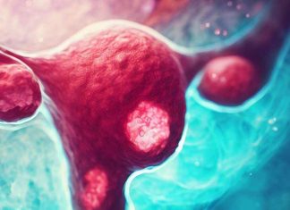 Occupational Exposures and Ovarian Cancer Risk
