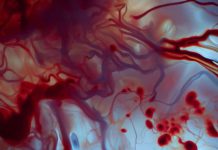 Association Between Spontaneous Intracerebral Hemorrhage and Blood Donors: A Retrospective Cohort Study
