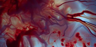 Association Between Spontaneous Intracerebral Hemorrhage and Blood Donors: A Retrospective Cohort Study