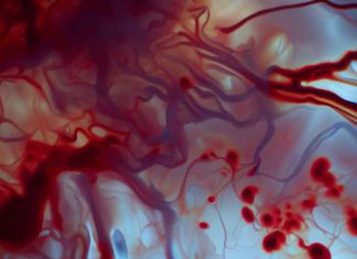 Association Between Spontaneous Intracerebral Hemorrhage and Blood Donors: A Retrospective Cohort Study