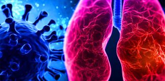 The Complex Interplay Between SARS-CoV-2 Infection, Lung Cancer, and Toll-Like Receptors