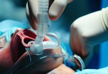 The Impact of COVID-19 on Swallowing and Airway Management in ICU Patients: A Retrospective Study