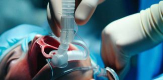 The Impact of COVID-19 on Swallowing and Airway Management in ICU Patients: A Retrospective Study