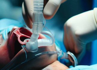 The Impact of COVID-19 on Swallowing and Airway Management in ICU Patients: A Retrospective Study