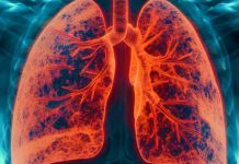 Exploring the Lung-Related Protein CRTAC1: Implications in COVID-19 Pathogenesis and Beyond