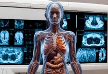 Assessing the Risk of Hematological Malignancies in Children and Adolescents Undergoing Computed Tomography: Insights from the EPI-CT Study