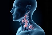 Dysphagia-Optimised Intensity-Modulated Radiotherapy: A Breakthrough in Mitigating Swallowing Dysfunction After Head and Neck Cancer Treatment