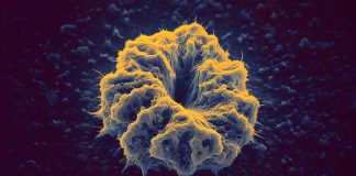 La lidocaina scatena l’apoptosi antitumorale negli HNSCC attraverso l’attivazione di T2R14