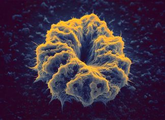La lidocaina scatena l’apoptosi antitumorale negli HNSCC attraverso l’attivazione di T2R14