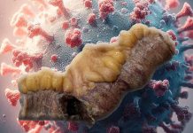Gastrointestinal Manifestations of SARS-CoV-2: A Comprehensive Examination of Mesenteric Ischemia