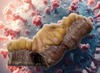 Gastrointestinal Manifestations of SARS-CoV-2: A Comprehensive Examination of Mesenteric Ischemia