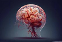SARS-CoV-2-Induced Transformation of Multiple Sclerosis into Tumefactive Demyelinating Lesions