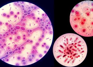 Alarming Surge in Sexually Transmitted Infections Demands Global Attention