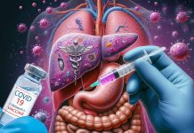 Rilevati Elevati livelli di CA 19-9 post-COVID-19 – esplorazione di casi non cancerosi con livelli di CA 19-9 superiori a 1.000 U/ml