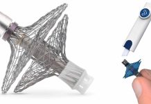 Revolutionizing Heart Failure Management: Vectorious’ V-LAP Sensor