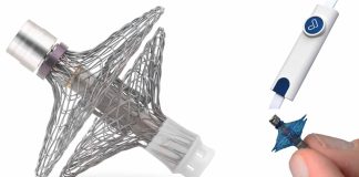 Revolutionizing Heart Failure Management: Vectorious’ V-LAP Sensor