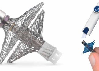 Revolutionizing Heart Failure Management: Vectorious’ V-LAP Sensor
